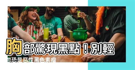 胸部長黑痣|別把癌當痣！5部位冒黑點恐是惡性黑色素瘤 台大醫師。